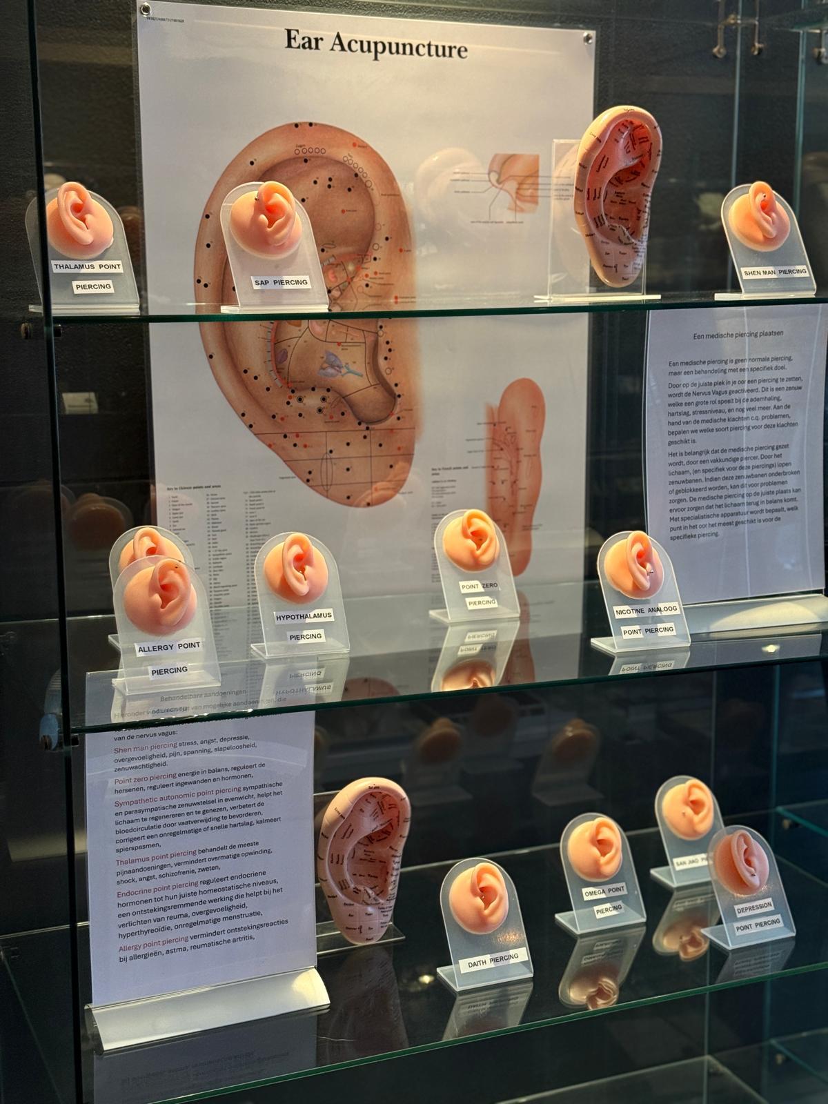 Medische oorpiercings