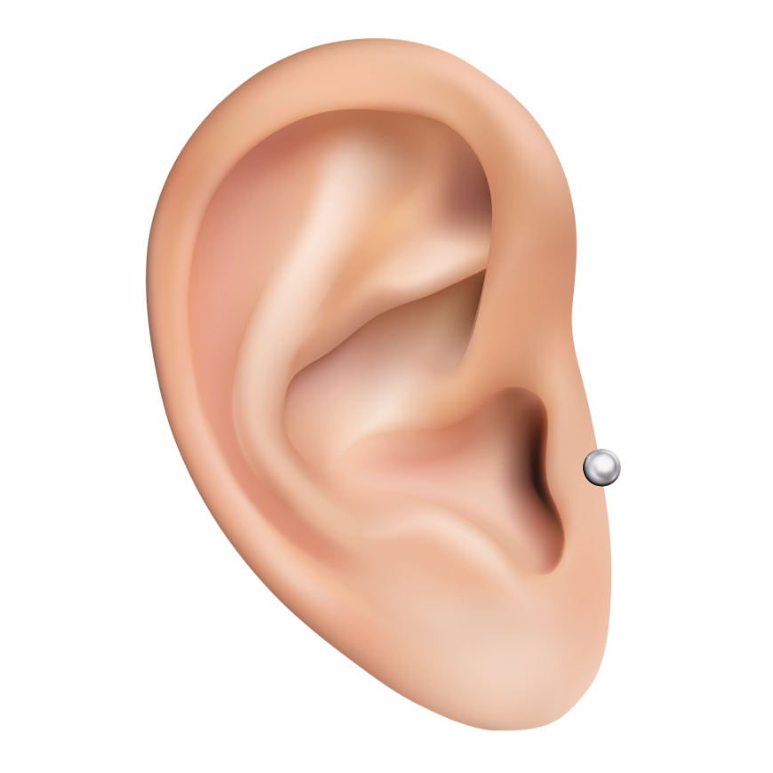 Medische piercings - Daith plaatsing